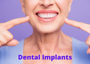 Middletown New Jersey Dentist | Why Choose Dental Implants From Rockwell Dentistry