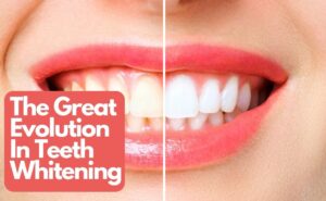 Middletown New Jersey Dentist | The Great Evolution of Teeth Whitening