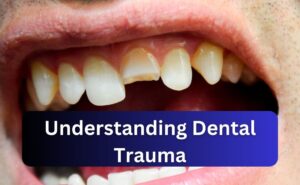 Middletown New Jersey Dentist | Have You Experienced Dental Trauma