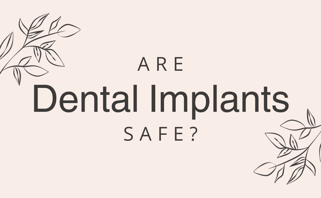 are dental implants safe