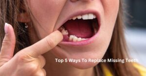 Middletown New Jersey Dentist | Top 5 Ways to Replace Missing Teeth