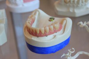 Middletown New Jersey Dentist | General Dentistry For Maximum Oral Health