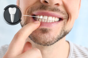 Middletown New Jersey Dentist | Dental Implants in Middletown, NJ: A Strong Foundation for a Confident Smile